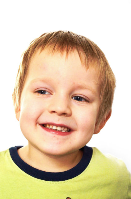 Happy child after surgery with Children Surgery